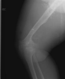 Sarasota Knee and Hip Replacement